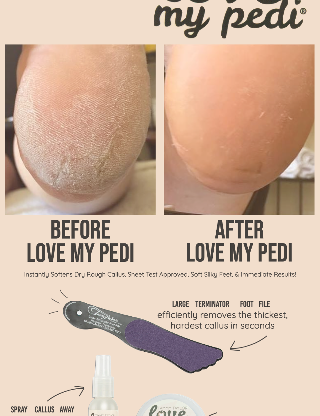 lovemypedibeforeafter_acdccef2-a333-4e7a-98d3-d368a9e17b6a.png